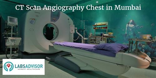 CT Scan Angiography Chest Cost In Mumbai Get Up To 10 OFF In Best