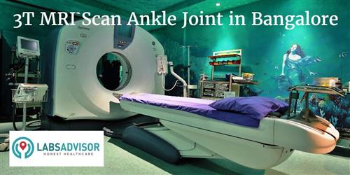 3t Mri Scan Ankle Joint Cost In Bangalore Bengaluru Get Up To 10