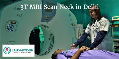 3T MRI Scan Neck Cost in Delhi - Get Up to 50% OFF in Best Lab(s ...