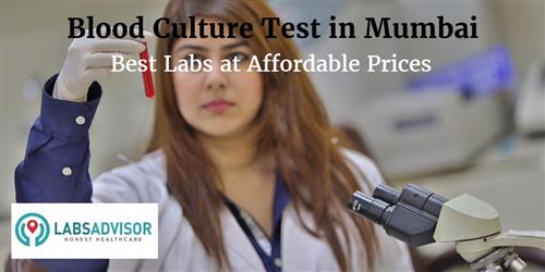 Blood Culture Test Cost In Mumbai - Get Up To 20% Discount In Best Lab 