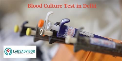 blood-culture-test-cost-in-delhi-get-up-to-30-off-in-best-lab-s