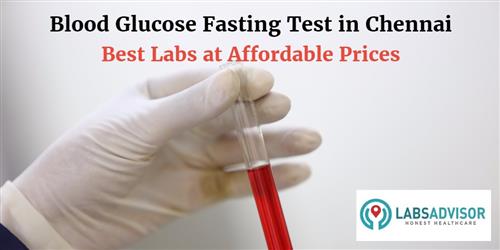 glucose fasting test cost