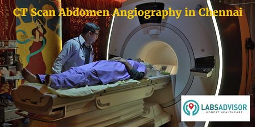 CT Scan Abdomen Angiography Cost in Chennai - Get Up to 0% Discount in ...