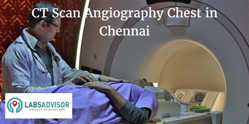 CT Scan Angiography Chest Cost in Chennai - Get Up to 0% OFF in Best ...