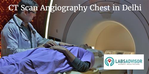 CT Scan Angiography Chest Cost in Delhi - Get Up to 30% Discount in ...