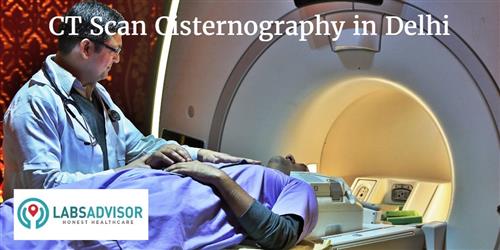 CT Scan Cisternography Cost in Delhi - Get Up to 30% OFF in Best Lab(s ...