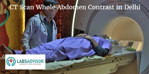 CT Scan Whole Abdomen Contrast Cost in Delhi - Get Up to 40% Discount ...