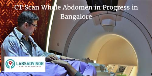 CT Scan Whole Abdomen Cost in Bangalore / Bengaluru - Get Up to 15% ...