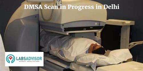 Dmsa Scan Cost In Delhi Get Up To 20 Off In Best Lab S Labsadvisor