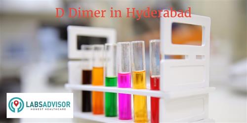 D Dimer Test Cost in Hyderabad - Get Up to 25% OFF in Best Lab(s Sns-Brigh10