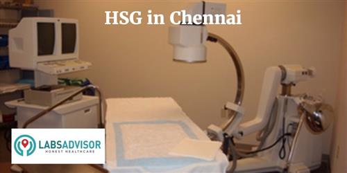 hbsag-rapid-test-at-rs-900-piece-rapid-cards-in-chennai-id-10085322633