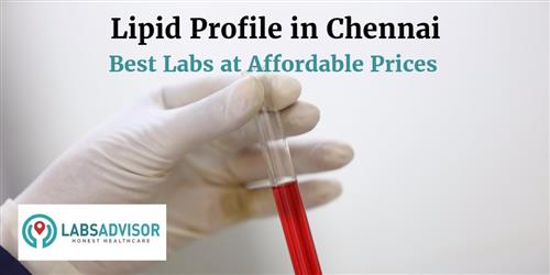 lipid-profile-cost-in-chennai-get-up-to-25-off-in-best-lab-s-labsadvisor