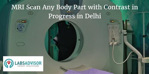 MRI Scan Any Body Part with Contrast Cost in Delhi - Get Up to 27% OFF ...