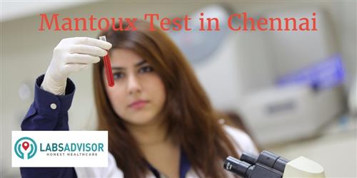 mantoux-test-cost-in-chennai-get-up-to-25-discount-in-best-lab-s