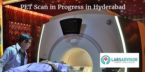 PET Scan Cost in Hyderabad - Get Up to 17% Discount in Best Lab(s ...