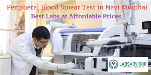 peripheral-blood-smear-test-cost-in-navi-mumbai-get-up-to-25-off-in