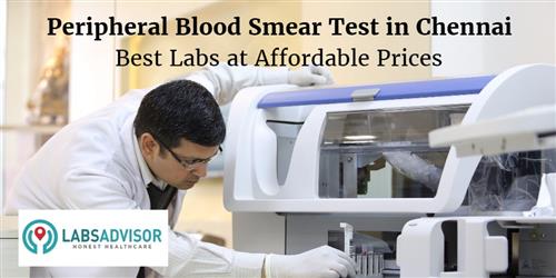 Peripheral Blood Smear Test Cost in Chennai - Get Up to 25% OFF in Best ...