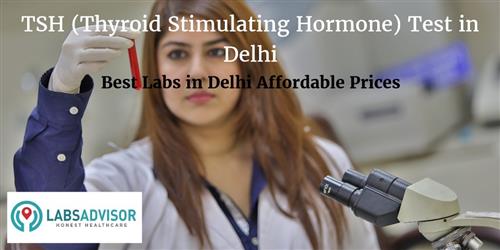 check up cost thyroid ) TSH Stimulating Hormone Up Thyroid  Get in ( Cost Delhi