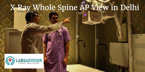 X-ray Dorso Lumbar Spine LAT View, Test Price in Delhi